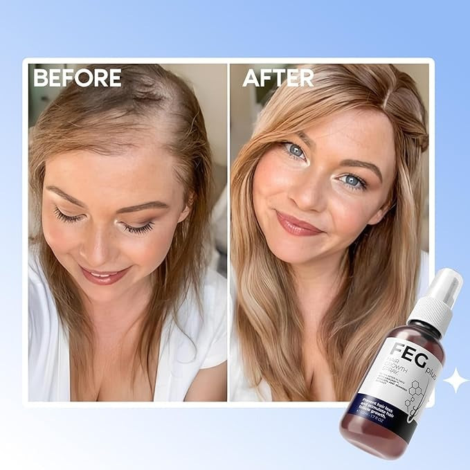 Hair Growth Spray